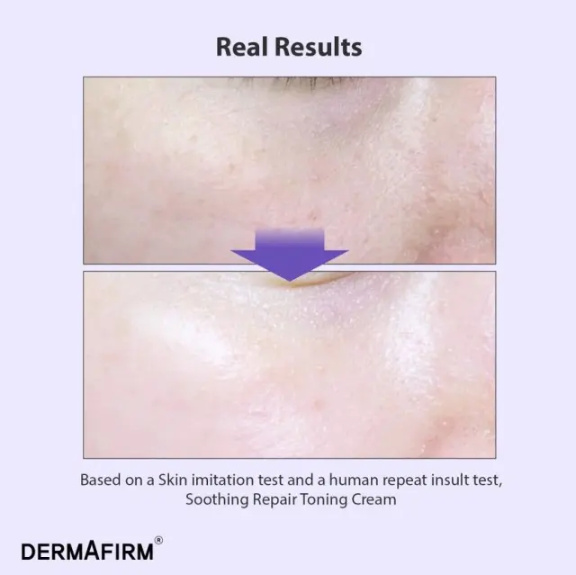 Dermafirm Soothing Repair Toning Cream R4 Καταπραϋντική Κρέμα Επανόρθωσης και Τόνωσης 50gr 2