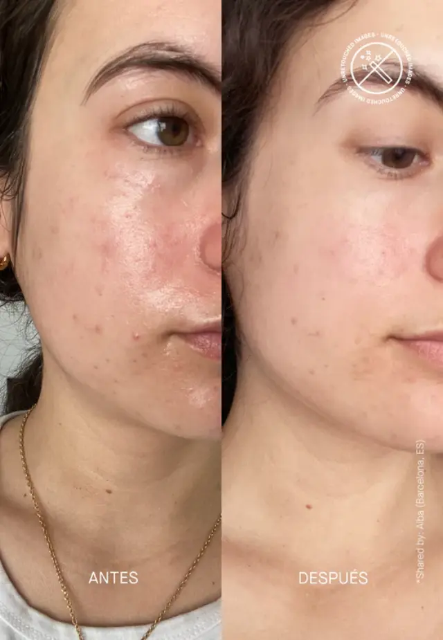 Niche Beauty Lab - Transparent Lab - Barrier Restoring Hydrating Cream - Κρέμα Φραγμού και Ενυδάτωσης 50ml 2