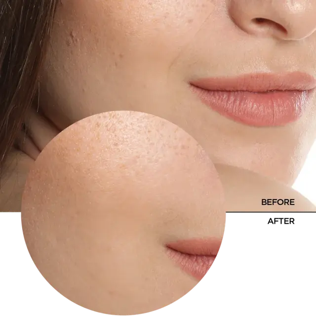 Revox B77 Just Hyaluronic Acid 5% Serum Ορός Προσώπου 30ml 3