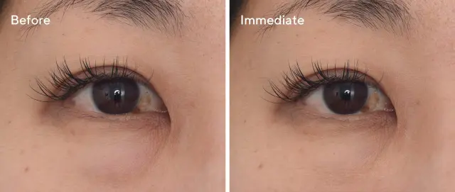 Murad Targeted Eye Depuffer Τοπική Θεραπεία Ματιών για Μαύρους Κύκλους 15ml 2