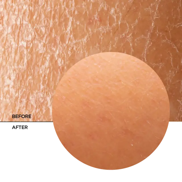 Revox B77 Skintreats Biotic Regenerating Filling Balm προσώπου για Ενυδάτωση & Ανάπλαση με Υαλουρονικό Οξύ & Βιταμίνη C 50ml 3
