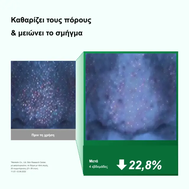 Anua Heartleaf Pore Control Cleansing Oil Έλαιο Καθαρισμού Προσώπου, 200ml 3