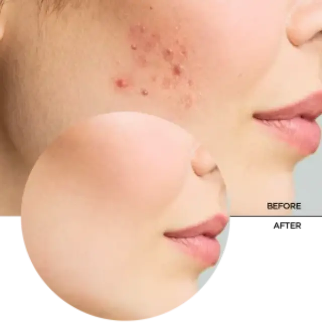 Revox B77 Zitcare AHA BHA PHA Active Face Toner 250ml 3
